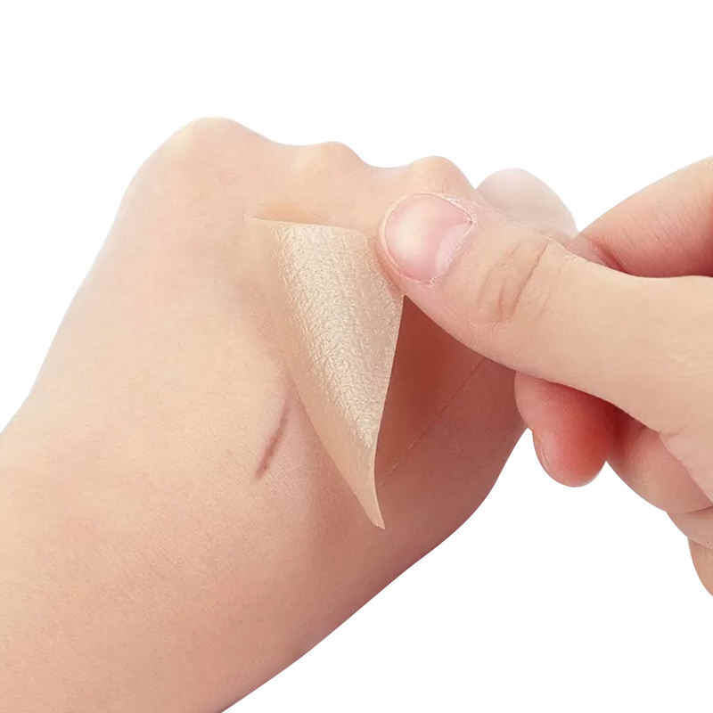 Kongdy|Silicone Scar Sheets