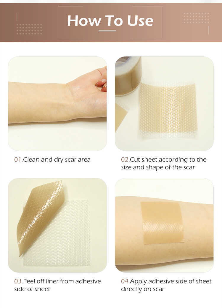 Silicone Scar Sheets(图8)
